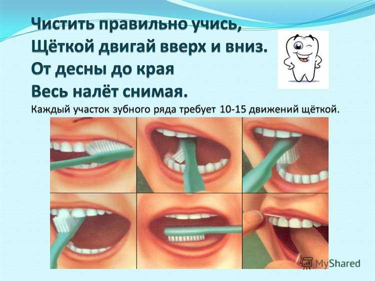 Не щеткой единой зубы живы